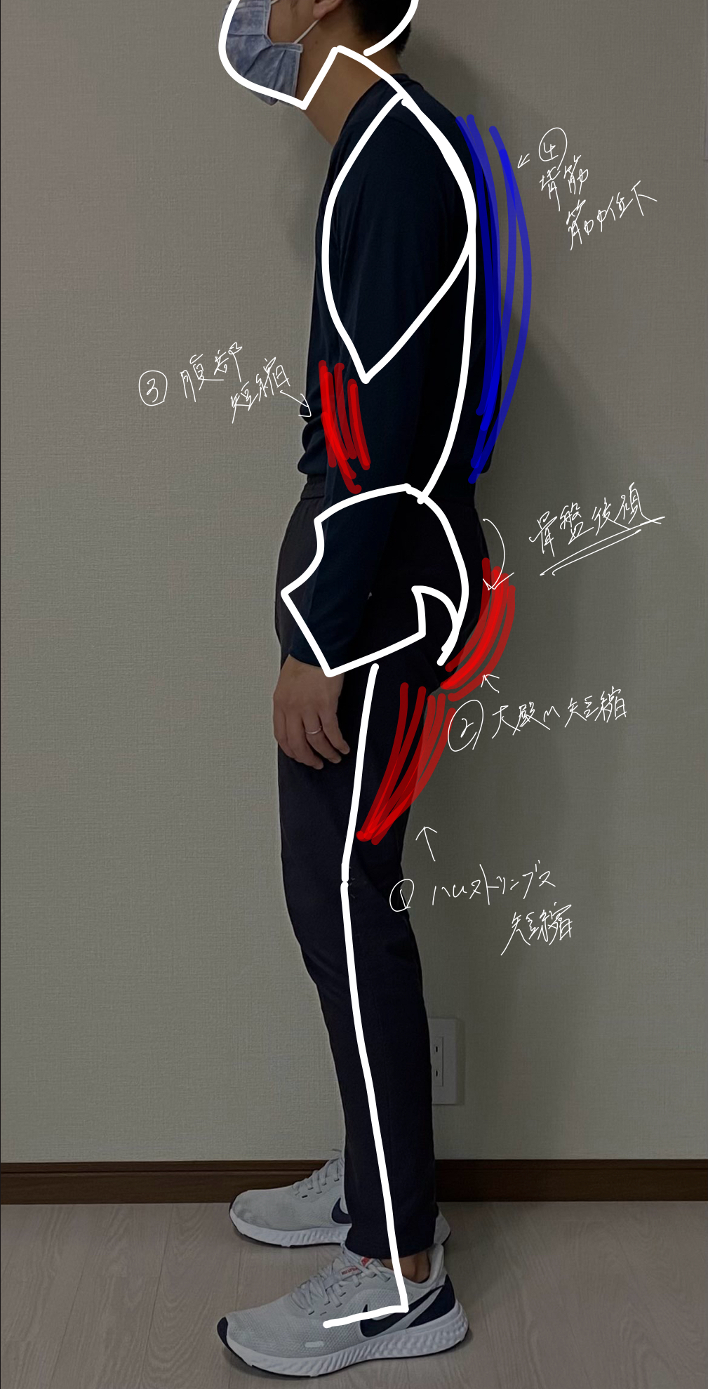 受け腰の原因