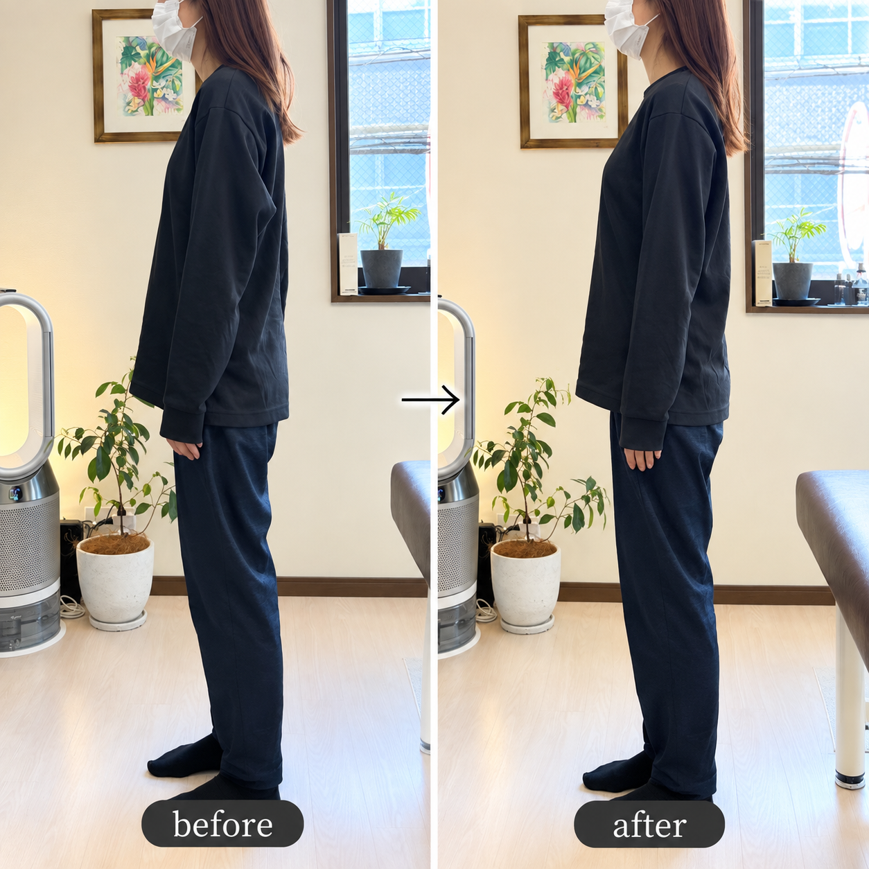 before/after巻き肩が改善し首の位置が変化