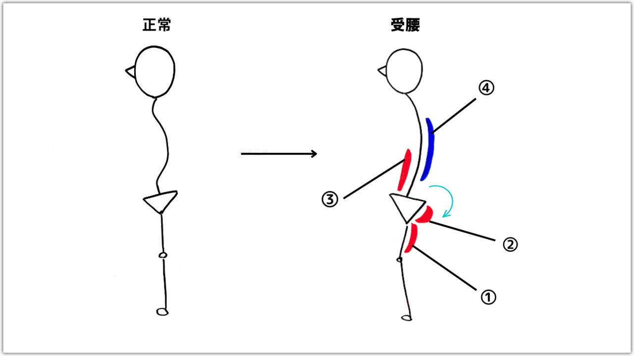 受腰の原因