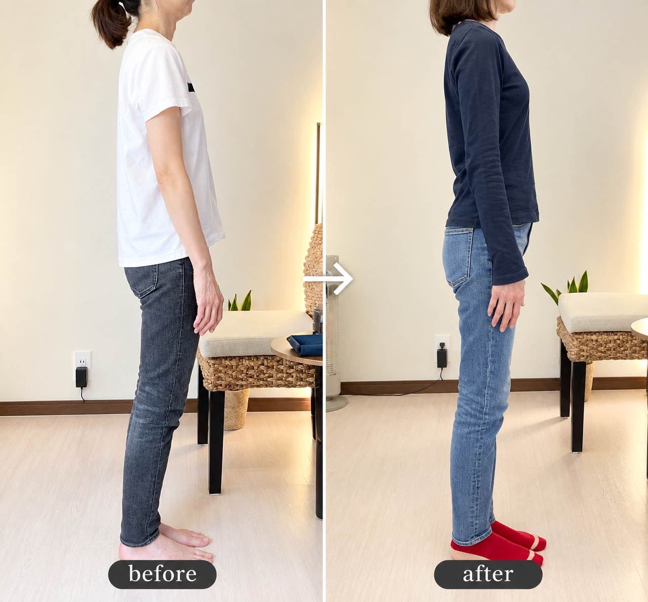 before/after 骨盤の位置が整い猫背が軽減