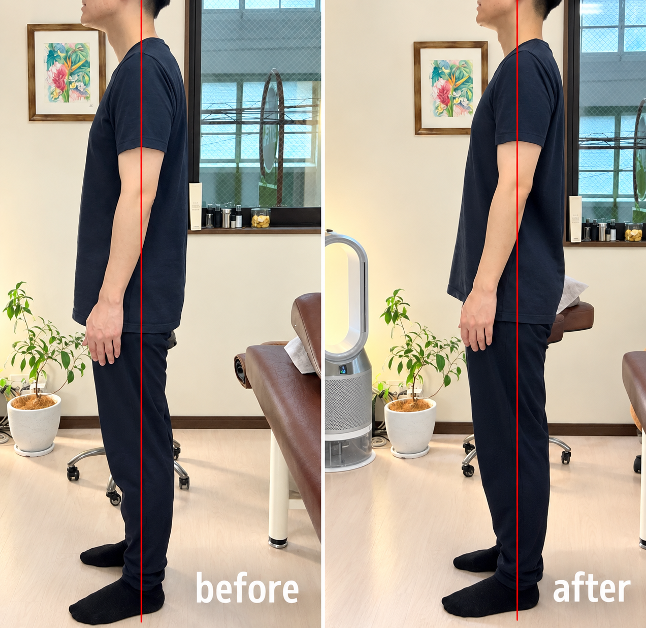 before/after 巻き肩、ストレートネックが軽減