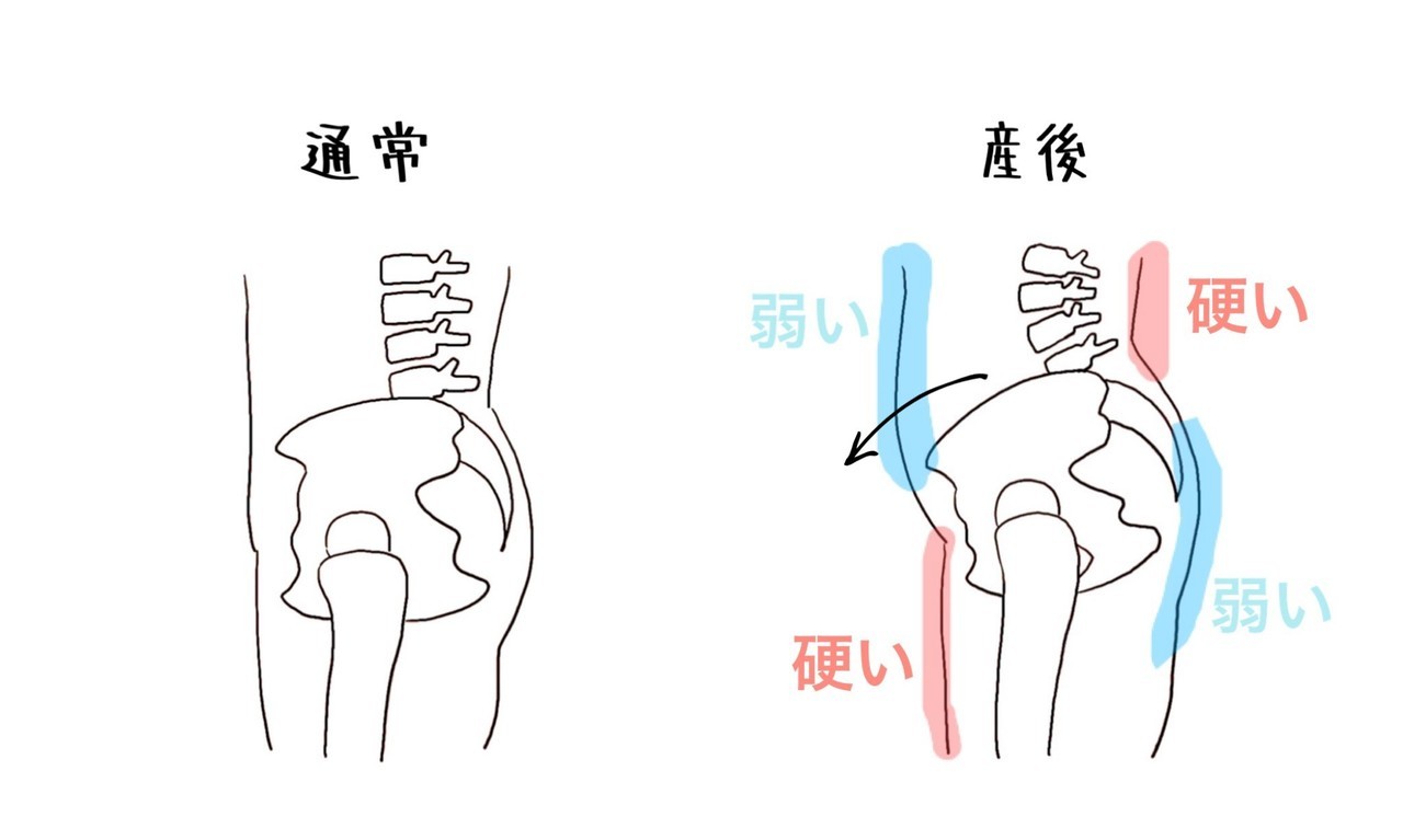 なぜ産後の骨盤矯正を受けた方が良いのか