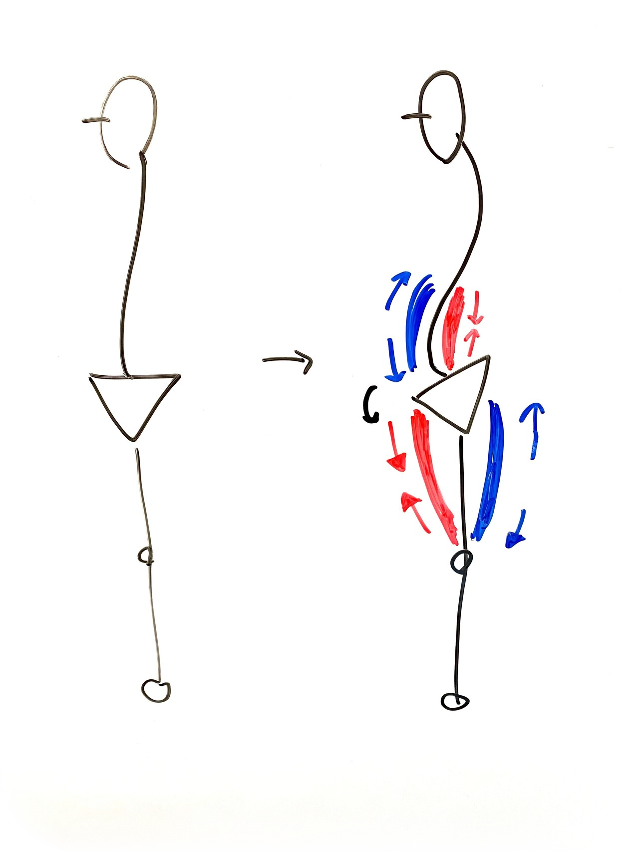 反り腰の原因とは？