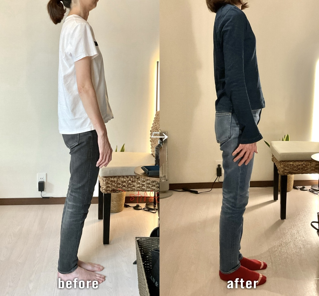 before/after 骨盤の位置が整い猫背が軽減