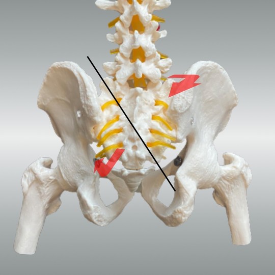 仙骨左斜方軸右回旋