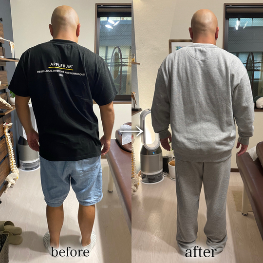 before/after 背骨の歪みが軽減