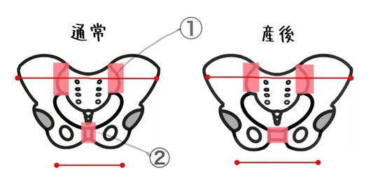 産後の骨盤の状態