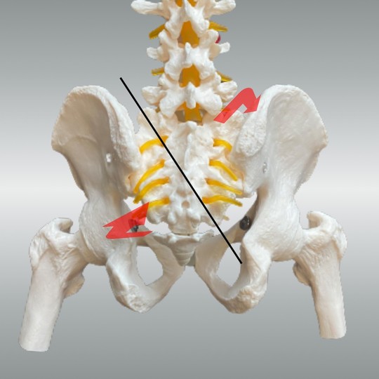 仙骨左斜方軸左回旋