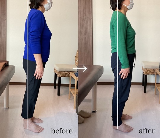 before/after重心が変化し姿勢がキレイに