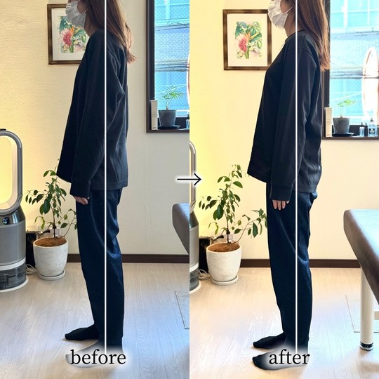 before/after巻き肩が改善し首の位置が変化