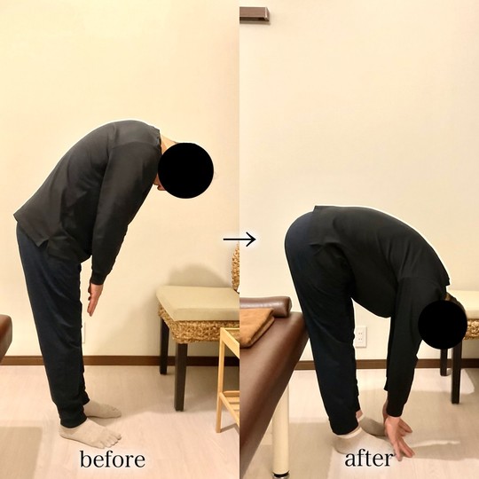 before/after 腰のこわばりが軽減し、身体が動くように