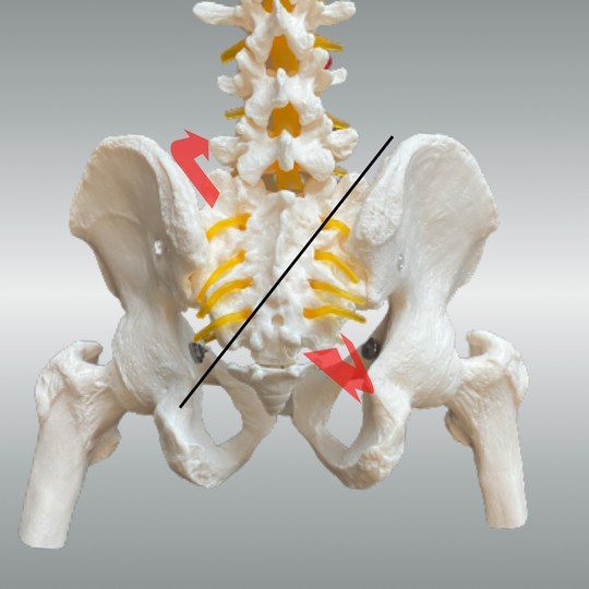 仙骨右斜方軸右回旋