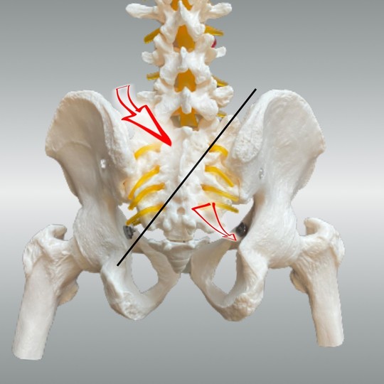 仙骨右斜軸左回旋