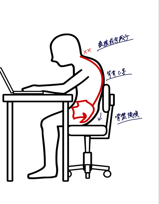 ストレートネックの原因についての解説