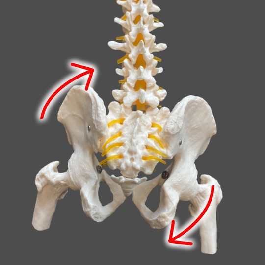骨盤の側屈変位