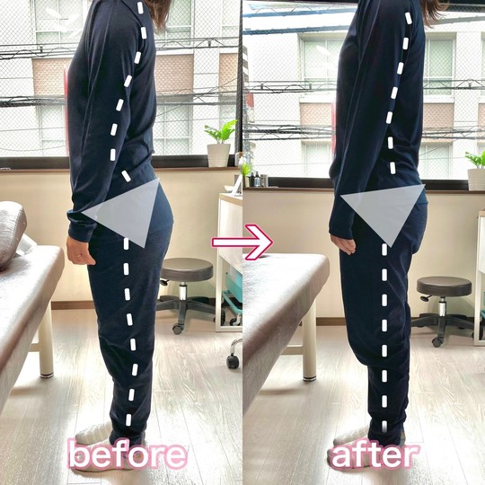 整体院CUCULE 池上がご紹介する反り腰改善エクササイズ