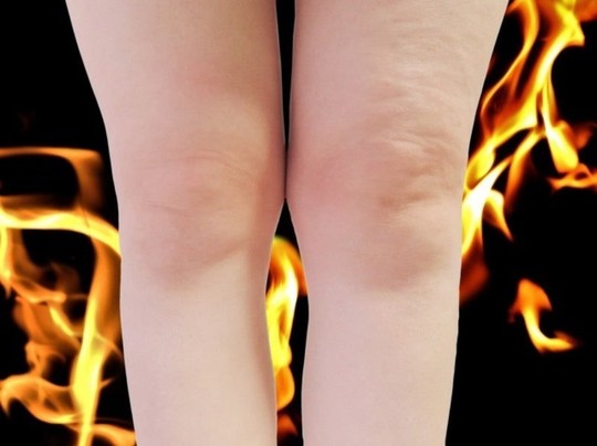 下半身太りは内股のせい？