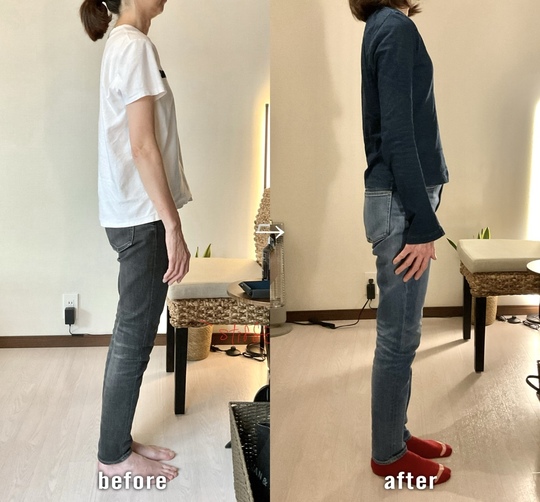 before/after 骨盤の位置が整い猫背が軽減