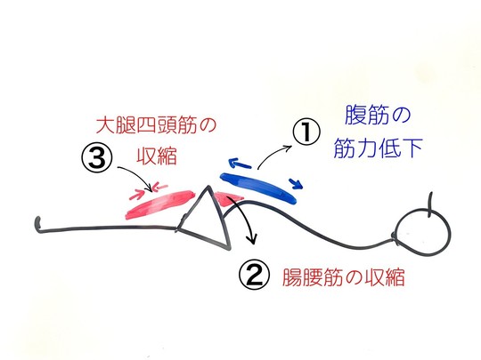 仰向けで寝ると腰が痛む原因